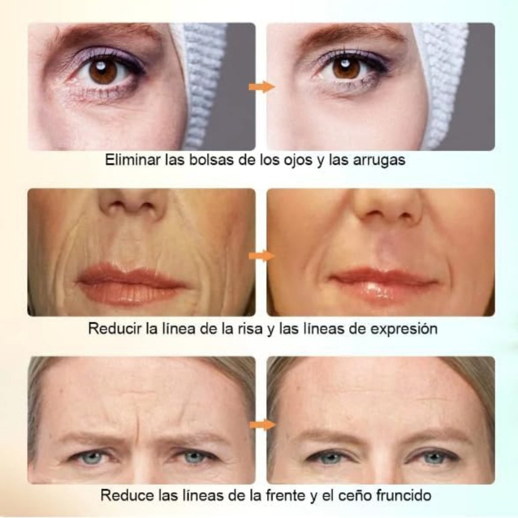 Masajeador Facial Skin Led
